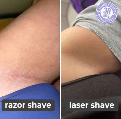 Painless Facial Body Hair all in one Trimmer